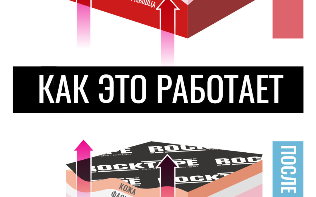 Как работает кинезио тейп RockTape?